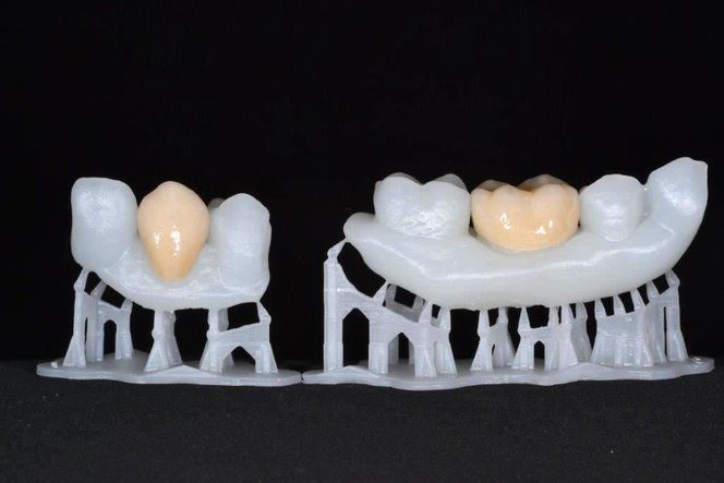 3 d-printing-dentistry-3d-printing-dental-ceramics